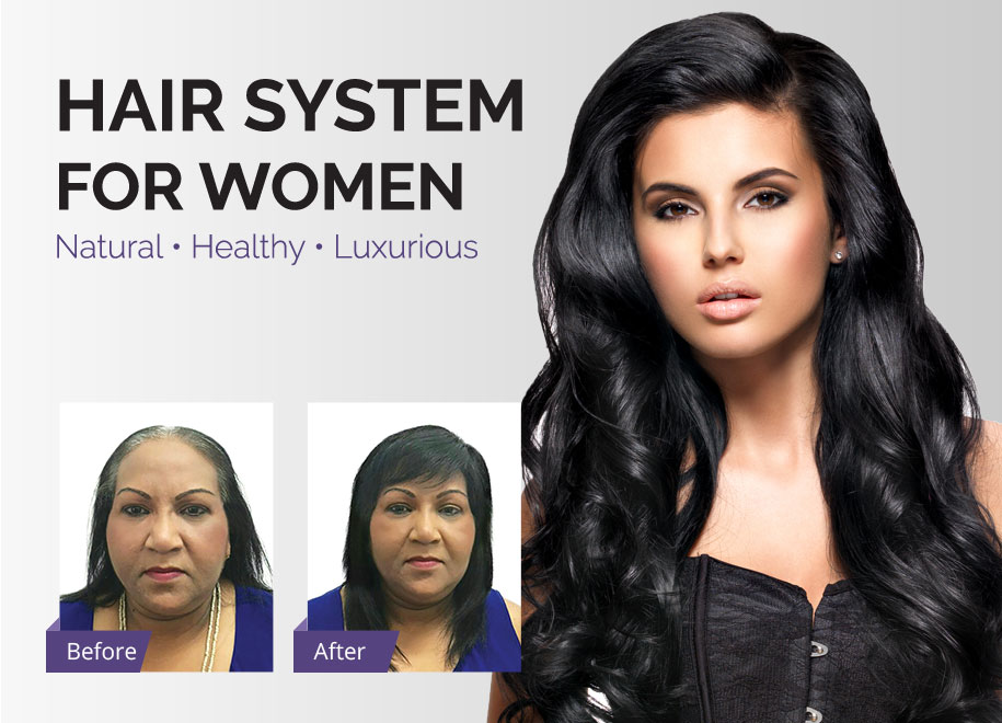 Superior Hair Replacement - Non-surgical Hair Replacement Systems | Hair  Loss Solutions